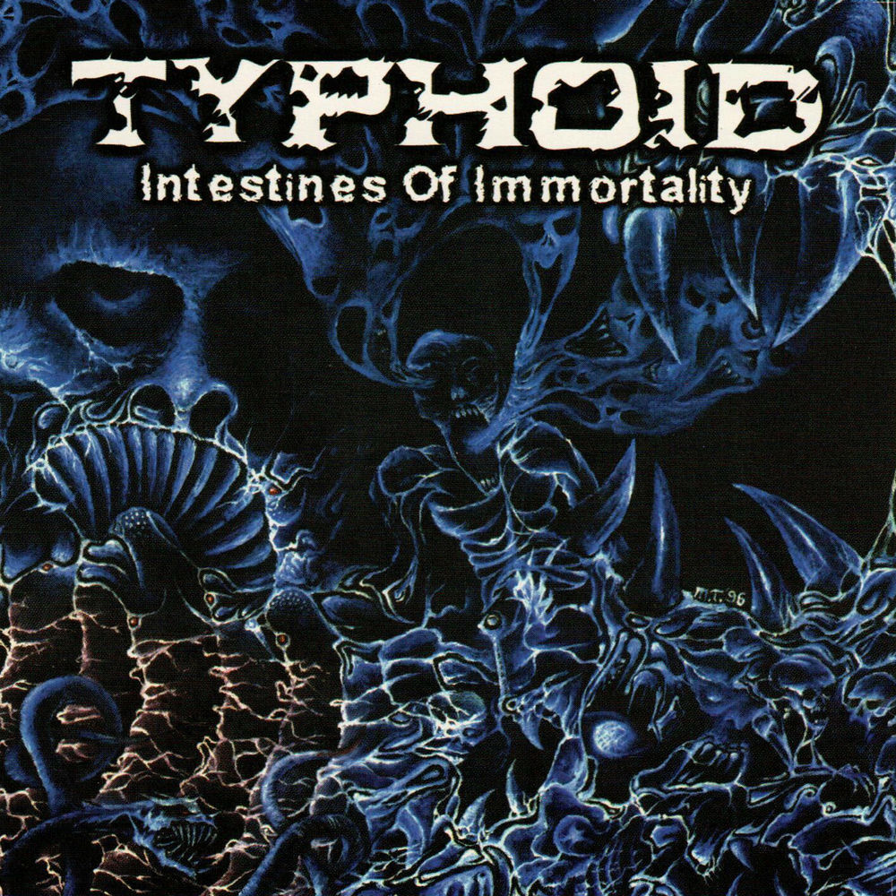 Typhoid