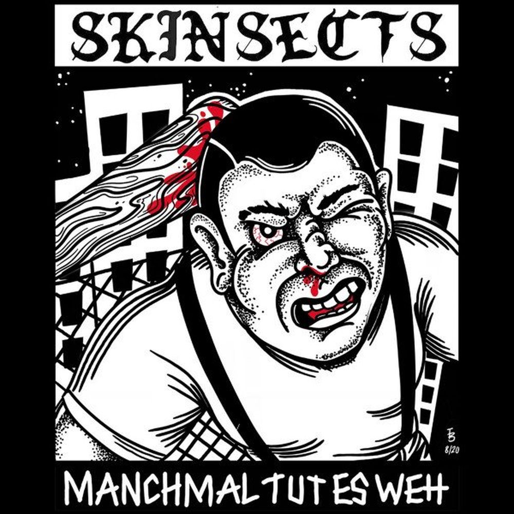Skinsect