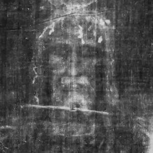 Shroud of Turin: The Face of Jesus Christ?