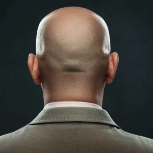 Why On Earth Do Men Go Bald?