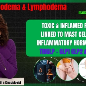 411: 💙 LIPOEDEMA & LYMPHOEDEMA: UNDERSTANDING THE BODY, SUPPORTING THE SYSTEM, AND FINDING REAL HELP