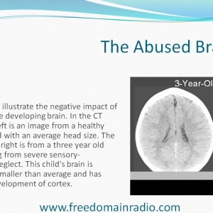 1538 The Bomb in the Brain - The Effects of Child Abuse Part 1