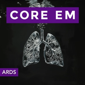 Episode 195: ARDS