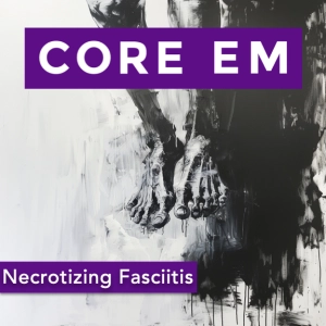 Episode 204: Necrotizing Fasciitis