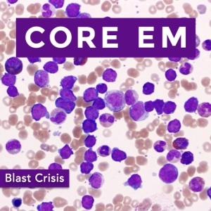 Episode 209: Blast Crisis