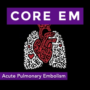 Episode 214: Acute Pulmonary Embolism