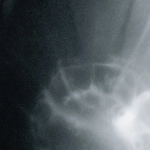 Cygnus The Swan