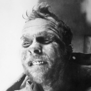 87: The Mad Trapper of Rat River