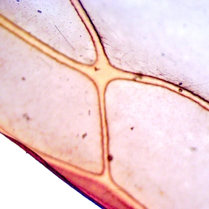 Episode 247—Watching The Dance Of The Ants
