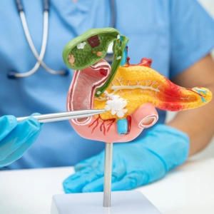 Pancreatic cancer is a terrible disease. Here's everything you need to know