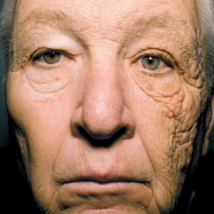 Going Beyond Sun Protection