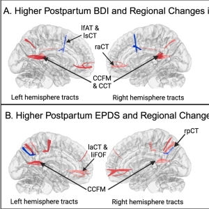 The new science of 'dad brain'