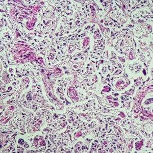 Natashia Weir, Jo Ireland - Can IDEXX Angio Detect™ accurately detect canine Angiostrongylosis?