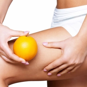 TIPOS DE CELULITIS, con Dra. Helga Rivera