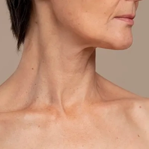 EL CUELLO NO ENGAÑA I, con Dra. Helga Rivera