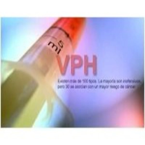 Vírus de Papiloma Humano 'VHP', con Nino Canún.