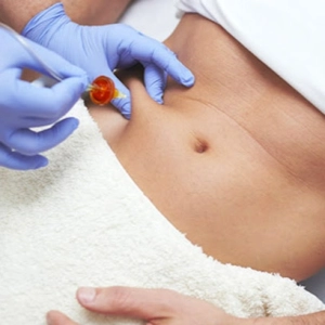 CARBOXITERAPIA, con Dra. Helga Rivera