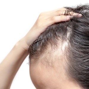 CUIDA TU PELO, con Dra. Helga Rivera