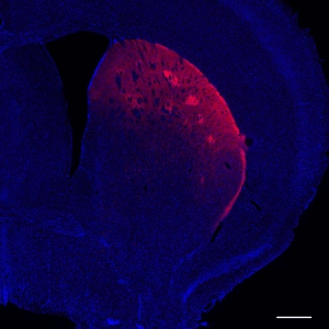 New Insights into Dopamine with Raj Awatramani, PhD, and Daniel Dombeck, PhD