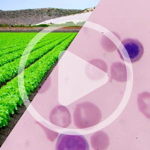 Large-scale Food and the Cyclospora Outbreak
