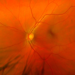 Identifying the Mechanisms of Seeing Color with Jeremy Nathans, MD, PhD