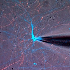 Investigating Therapies for Genetic Epilepsy with Alfred George, Jr., MD