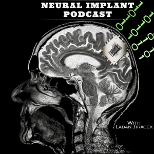 Bonus! Promo for Neural Implant podcast, the other show I just launched