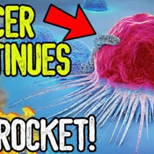 CANCER CONTINUES TO SKYROCKET! - What You Need To Know!