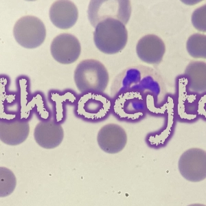 152 Erythrocytosis