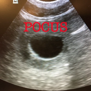 55 POCUS