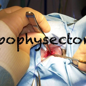 70 Hypophysectomy