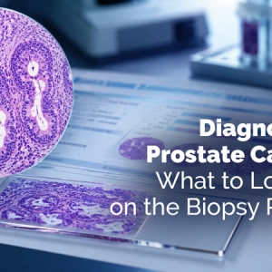 Diagnosis of Prostate Cancer: What to Look for on the Biopsy Report